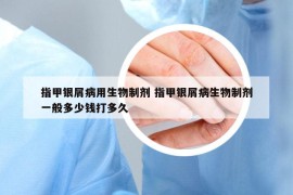 指甲银屑病用生物制剂 指甲银屑病生物制剂一般多少钱打多久
