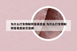 为什么打生物制剂容易感染 为什么打生物制剂容易感染艾滋病