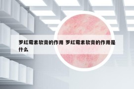 罗红霉素软膏的作用 罗红霉素软膏的作用是什么