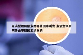 点滴型银屑病多由哪些因素诱发 点滴型银屑病多由哪些因素诱发的
