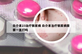 白介素23治疗银屑病 白介素治疗银屑病需要一直打吗