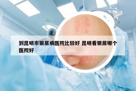 到昆明市银屑病医院比较好 昆明看银屑哪个医院好