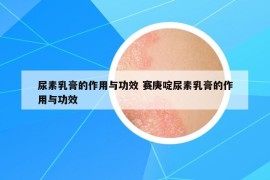 尿素乳膏的作用与功效 赛庚啶尿素乳膏的作用与功效