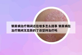银屑病治疗期间还在增多怎么回事 银屑病在治疗期间又出新的了该坚持治疗吗