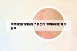 生物制剂打的频繁了会怎样 生物制剂打几次起效