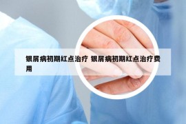 银屑病初期红点治疗 银屑病初期红点治疗费用
