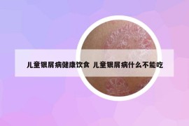 儿童银屑病健康饮食 儿童银屑病什么不能吃