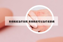青核桃皮治疗白斑 青核桃皮可以治疗皮肤病