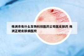 株洲市有什么生物科技医药公司医皮肤药 株洲正规皮肤病医院