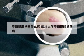 华西银屑病开什么药 四川大学华西医院银屑病