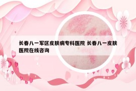 长春八一军区皮肤病专科医院 长春八一皮肤医院在线咨询