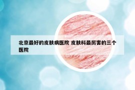北京最好的皮肤病医院 皮肤科最厉害的三个医院