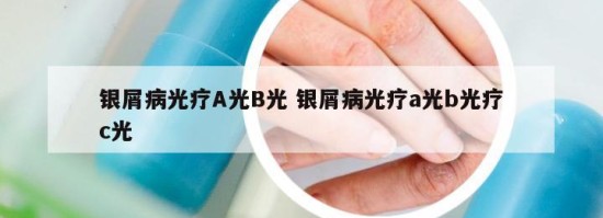 银屑病光疗A光B光 银屑病光疗a光b光疗c光
