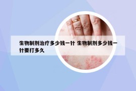 生物制剂治疗多少钱一针 生物制剂多少钱一针要打多久
