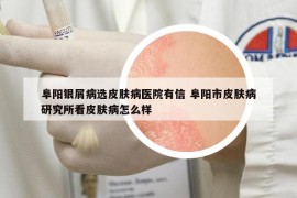 阜阳银屑病选皮肤病医院有信 阜阳市皮肤病研究所看皮肤病怎么样