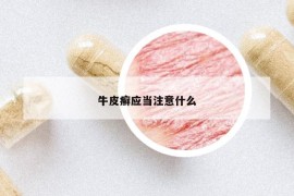 牛皮癣应当注意什么
