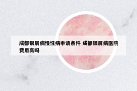 成都银屑病慢性病申请条件 成都银屑病医院费用高吗