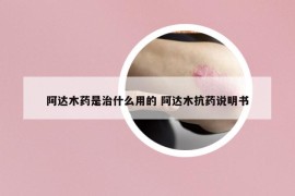 阿达木药是治什么用的 阿达木抗药说明书