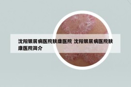沈阳银屑病医院肤康医院 沈阳银屑病医院肤康医院简介
