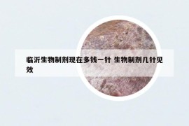 临沂生物制剂现在多钱一针 生物制剂几针见效