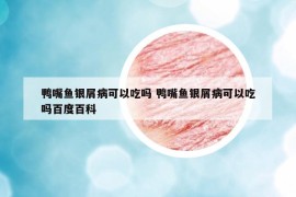 鸭嘴鱼银屑病可以吃吗 鸭嘴鱼银屑病可以吃吗百度百科