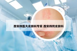 西安四医大皮肤科专家 西安四院皮肤科