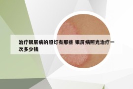 治疗银屑病的照灯有那些 银屑病照光治疗一次多少钱