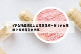 9岁女孩最近脸上出现就像癣一样 9岁女孩脸上长癣是怎么回事