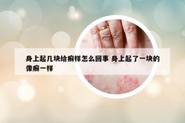 身上起几块给癣样怎么回事 身上起了一块的像癣一样