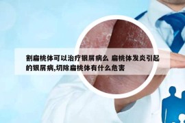 割扁桃体可以治疗银屑病么 扁桃体发炎引起的银屑病,切除扁桃体有什么危害