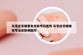 石家庄市那里有皮肤专科医院 石家庄市哪里有专治皮肤病医院