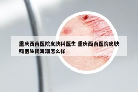 重庆西南医院皮肤科医生 重庆西南医院皮肤科医生杨海潮怎么样