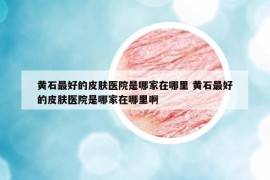 黄石最好的皮肤医院是哪家在哪里 黄石最好的皮肤医院是哪家在哪里啊