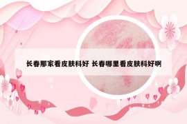 长春那家看皮肤科好 长春哪里看皮肤科好啊