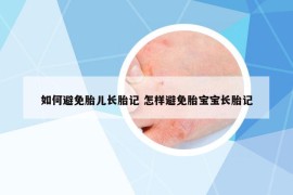 如何避免胎儿长胎记 怎样避免胎宝宝长胎记