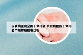 皮肤病医院全国十大排名 皮肤病医院十大排名广州市肤康电话呢