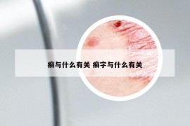 癣与什么有关 癣字与什么有关