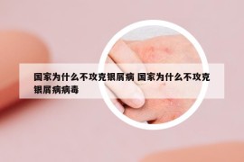 国家为什么不攻克银屑病 国家为什么不攻克银屑病病毒