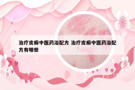 治疗皮癣中医药浴配方 治疗皮癣中医药浴配方有哪些