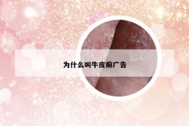 为什么叫牛皮癣广告
