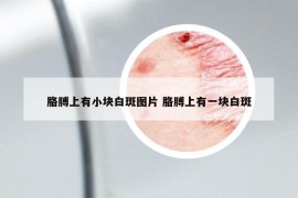 胳膊上有小块白斑图片 胳膊上有一块白斑