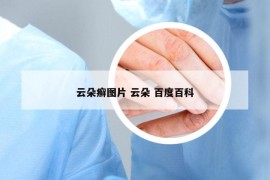 云朵癣图片 云朵 百度百科