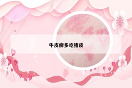 牛皮癣多吃猪皮