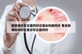 银屑病空军总医院好还是协和医院好 看皮肤病协和好还是空军总医院好