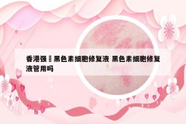 香港强燊黑色素细胞修复液 黑色素细胞修复液管用吗