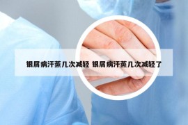 银屑病汗蒸几次减轻 银屑病汗蒸几次减轻了