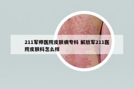 211军师医院皮肤病专科 解放军211医院皮肤科怎么样