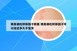 银屑病吃转移因子胶囊 银屑病吃转移因子可以延迟多久不复发