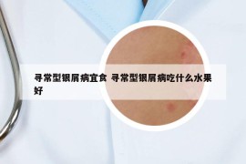 寻常型银屑病宜食 寻常型银屑病吃什么水果好