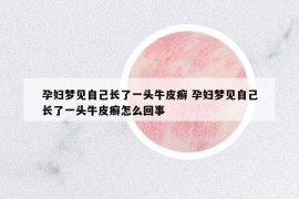 孕妇梦见自己长了一头牛皮癣 孕妇梦见自己长了一头牛皮癣怎么回事